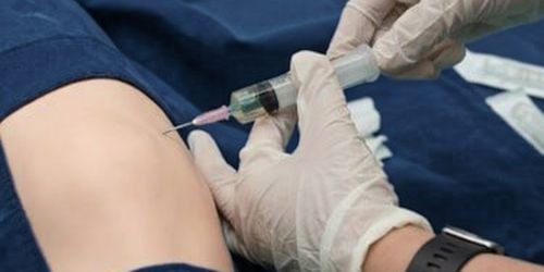 SERVIÇOS 7 Punção aspirativa por agulha fina