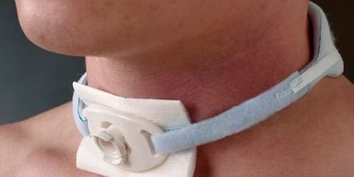 SERVIÇOS 10 Traqueostomia