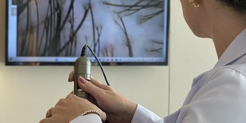 SERVIÇOS 13 Tricoscopia